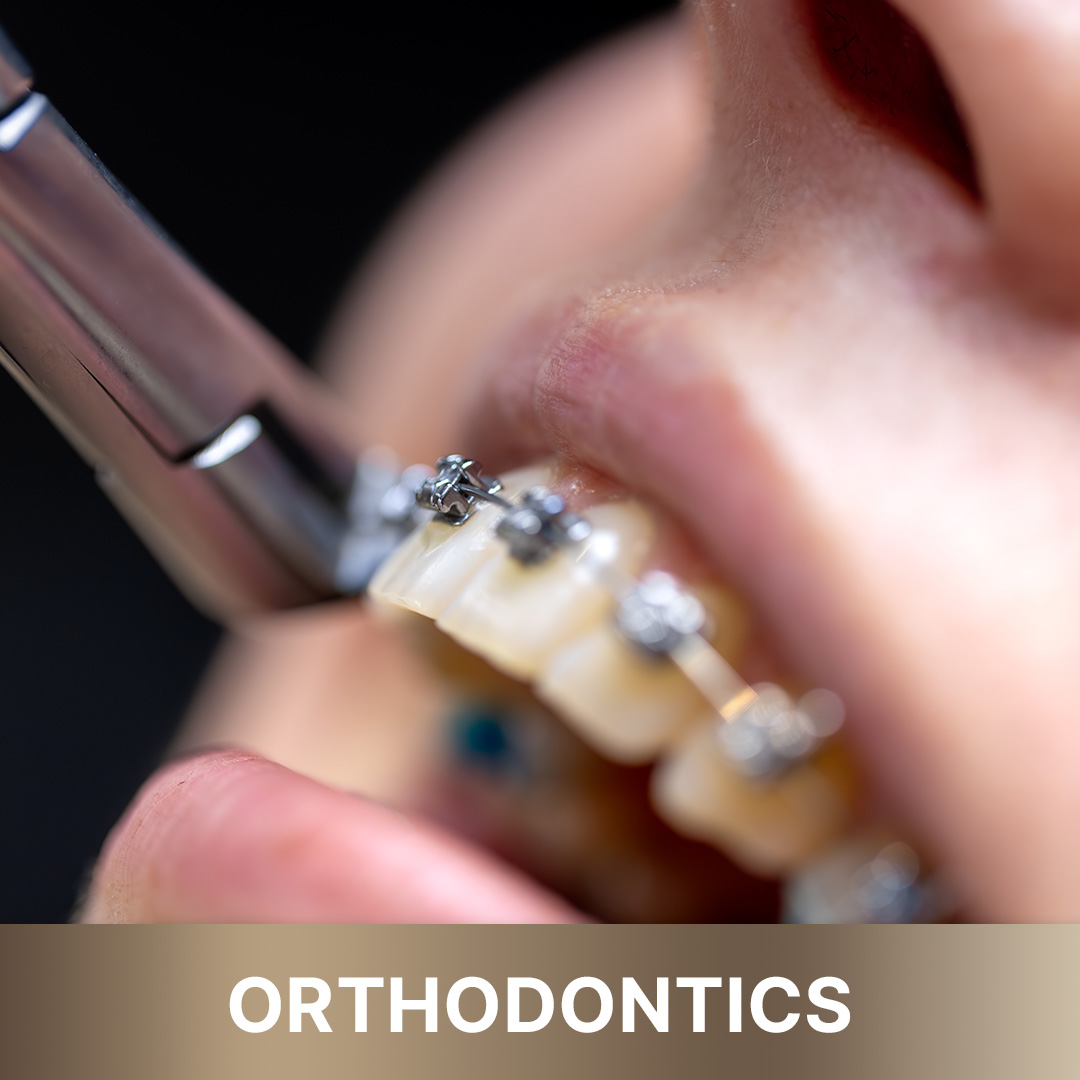 Orthodontics_1