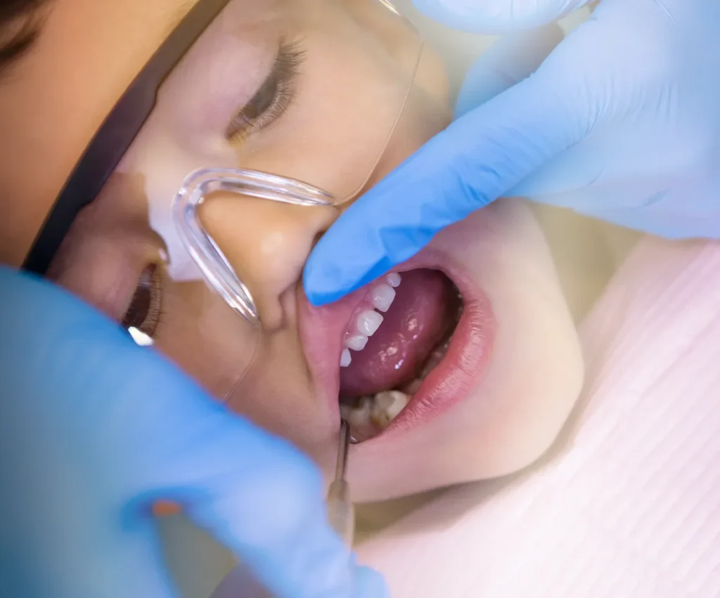 Pediatric dentist gently performing tooth extraction for a child
