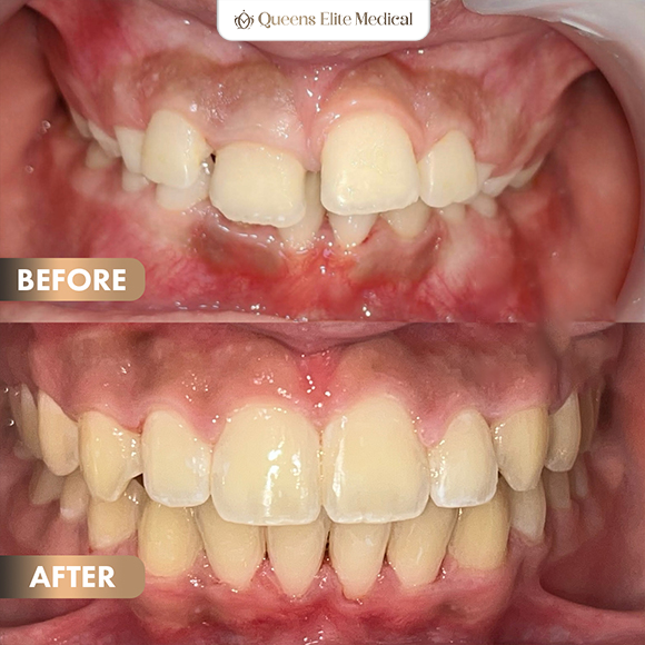 3BeforeAfter