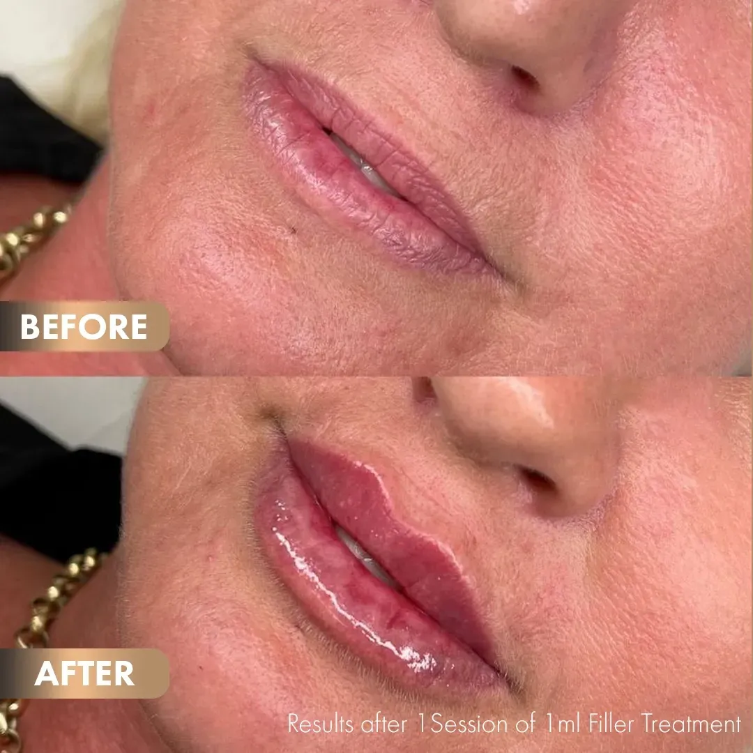 BA-Lips-3
