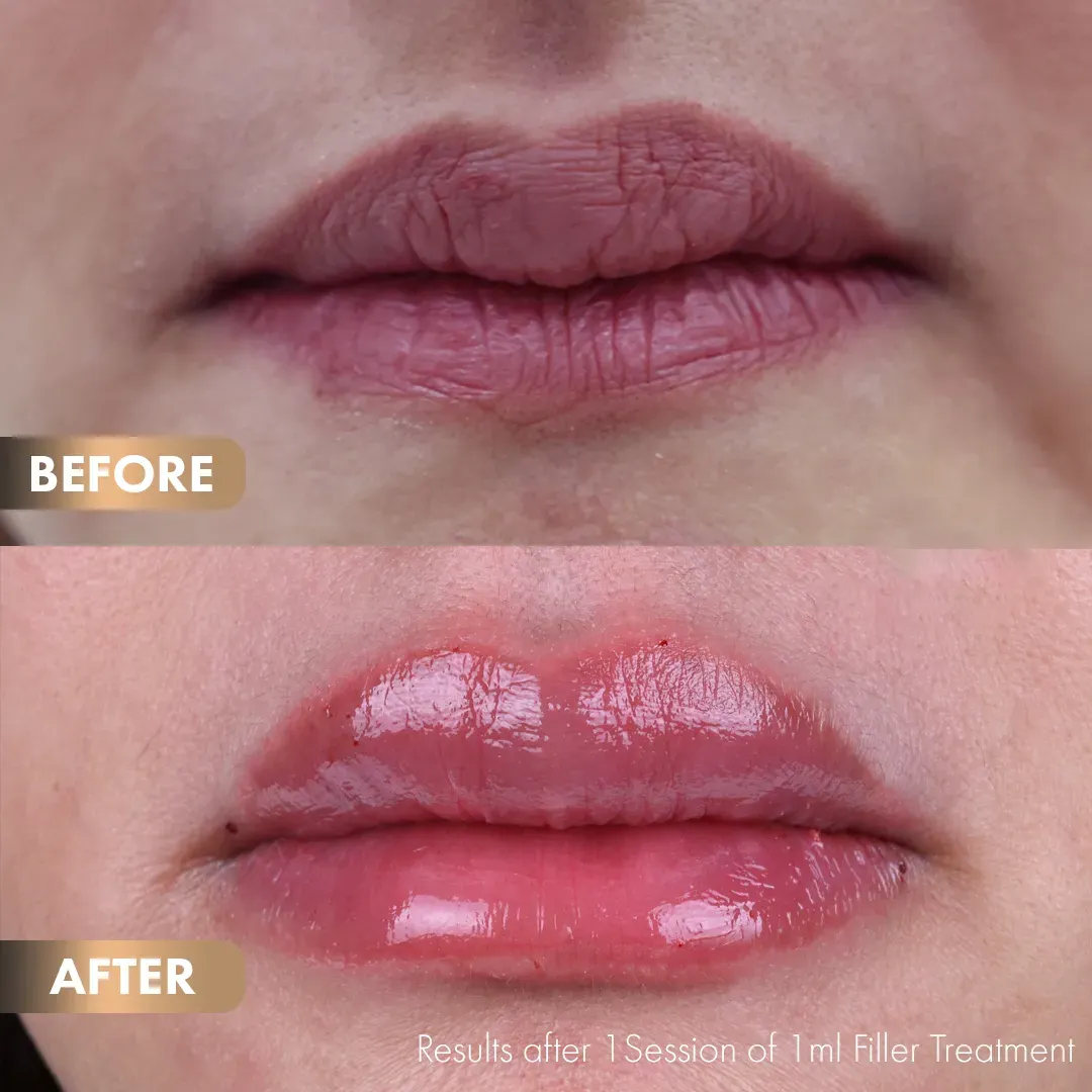 BA-Lips-5