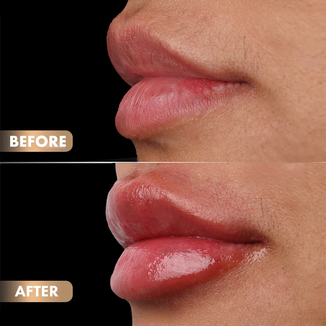 BA-Lips-6