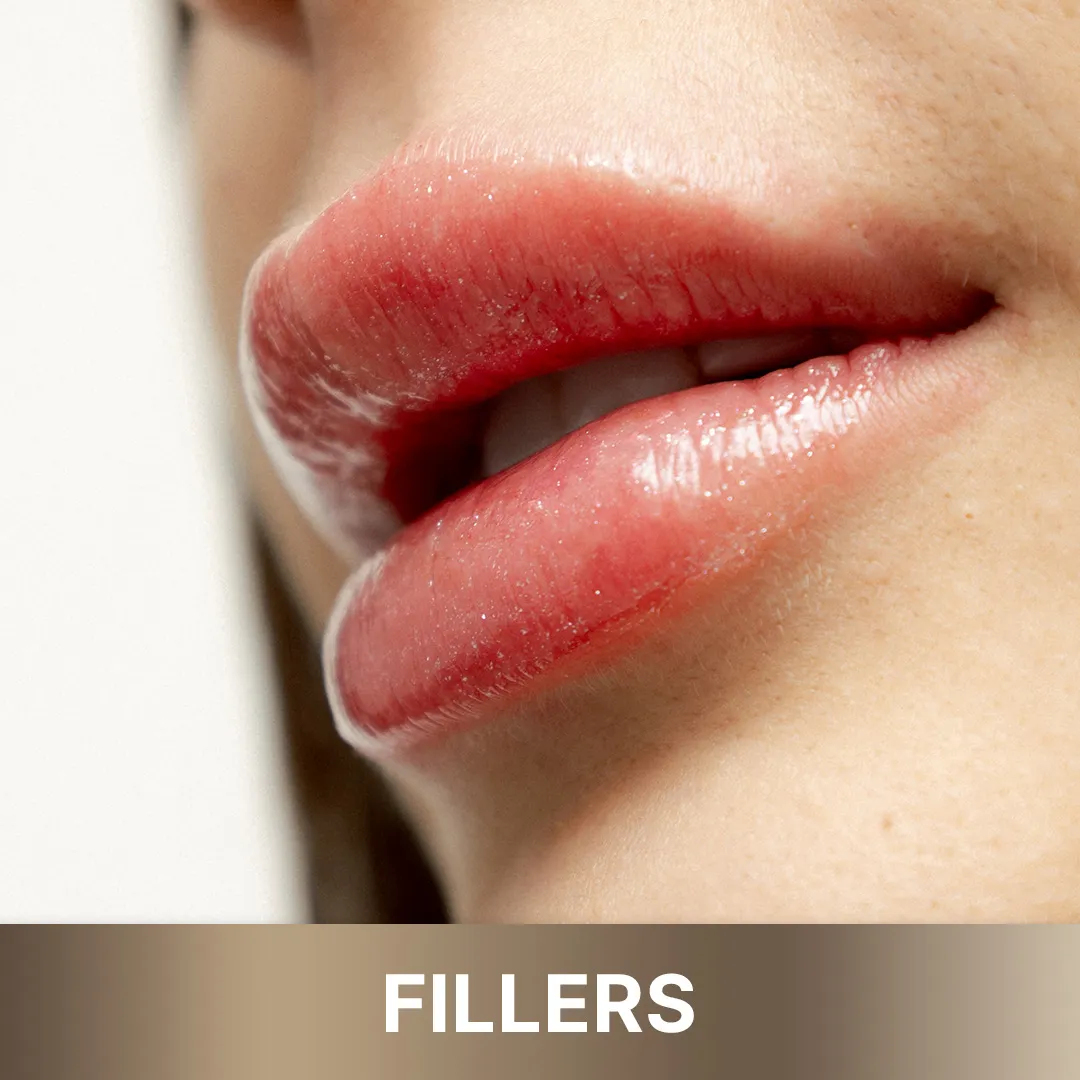 Subtly enhanced lips or cheeks showcasing natural-looking volume from 'Queens Elite' dermal filler treatment.