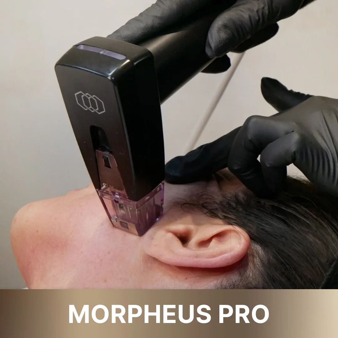 Smoother, more toned skin texture, demonstrating results from 'Morpheus Pro' treatment by 'Queens Elite'.