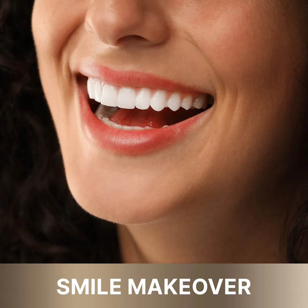 Smiling woman with perfect, bright teeth after a high-end 'Queens Elite' smile makeover.
