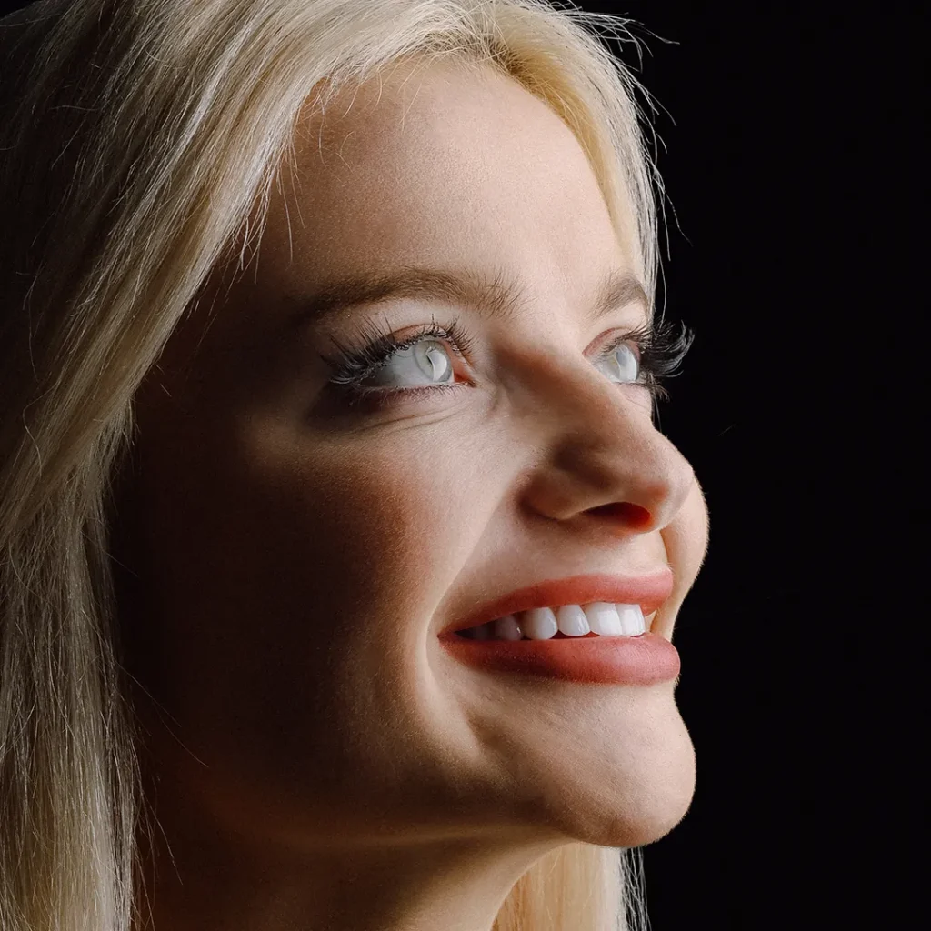 Porcelain veneers treatment for perfect smile in Dubai