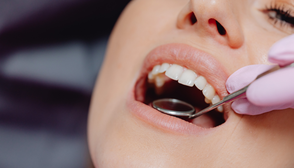 Professional Teeth Cleaning