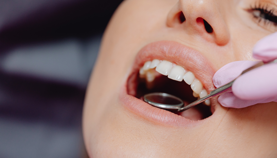 Professional Teeth Cleaning