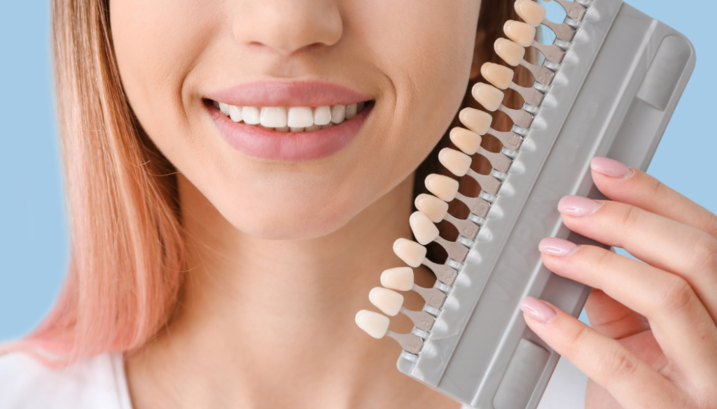 Composite Veneers in Dubai