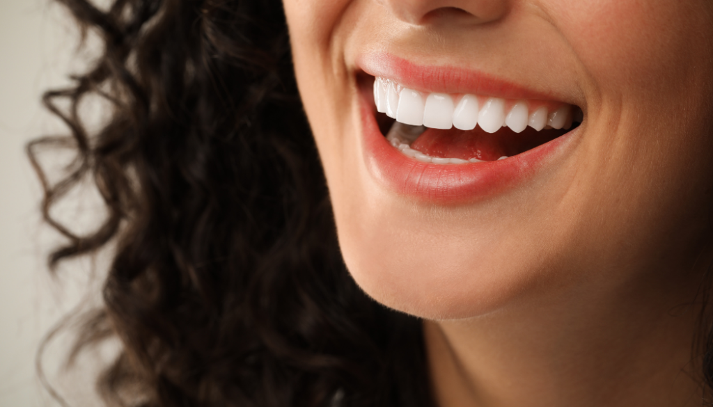 Feldspathic Veneers