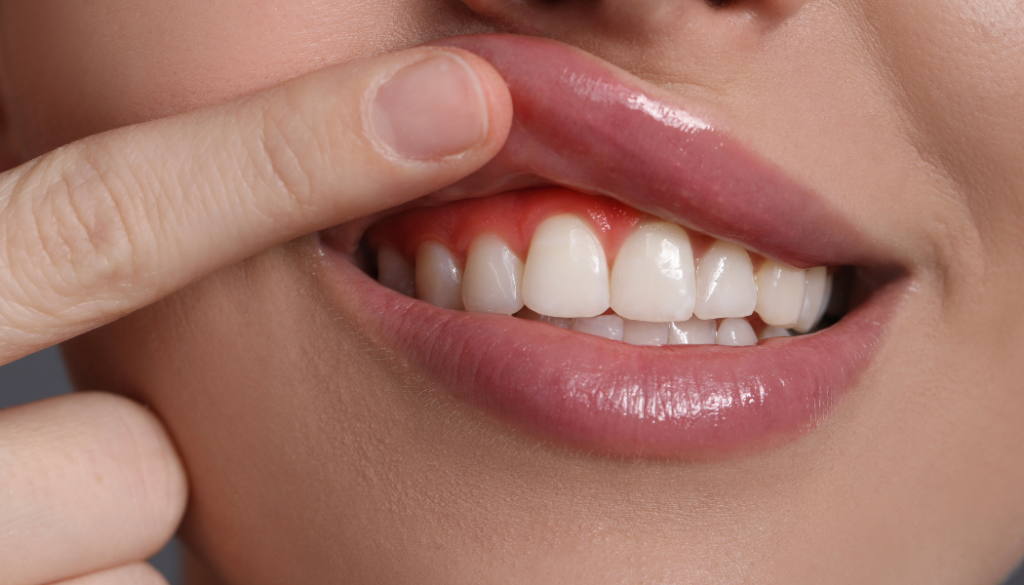 Advanced Gum Disease Treatments