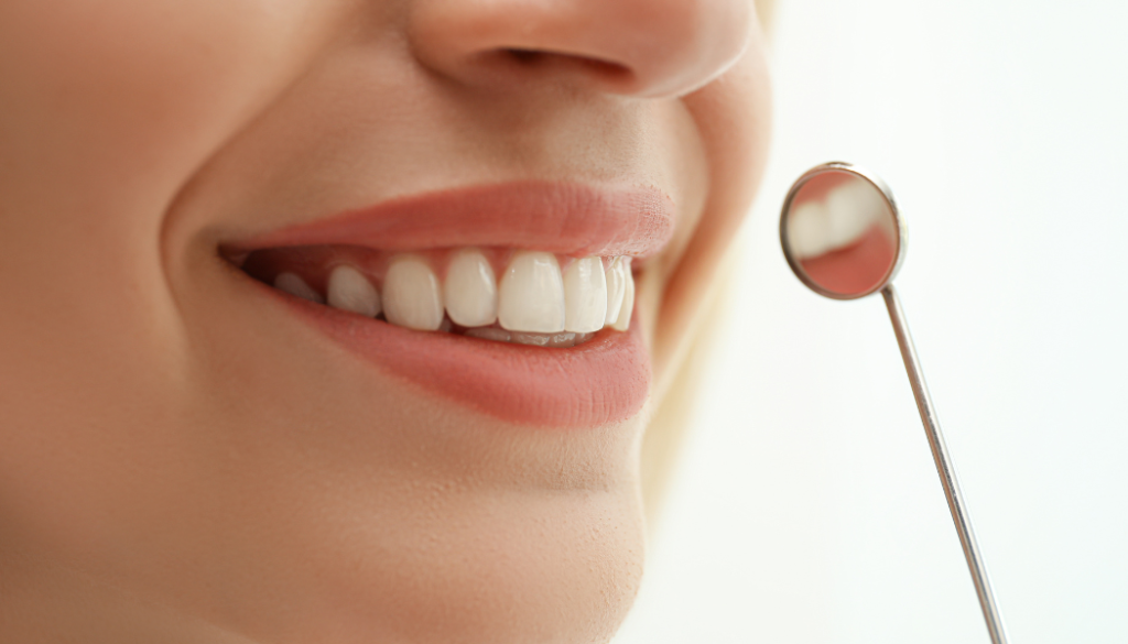 Common Smile Concerns in Dubai