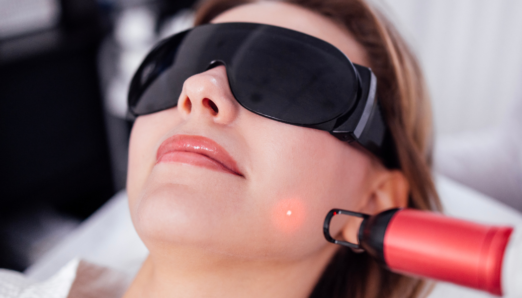 Endolift Treatment