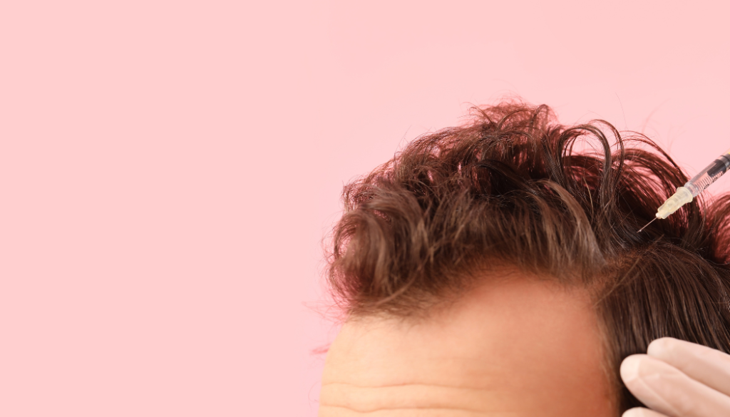 PRP for Hair Loss in Men vs Women